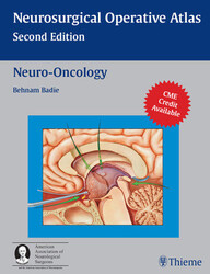 Neuro-oncology (Neurosurgical Operative Atlas) PDF