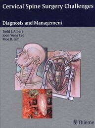 Cervical Spine Surgery Challenges: Diagnosis and Management 1st Edition PDF