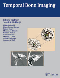Temporal Bone Imaging 1st Edition PDF