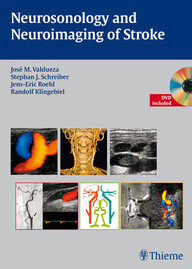 Neurosonology and Neuroimaging of Stroke PDF