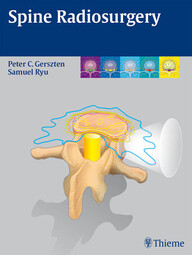 Spine Radiosurgery 1st Edition PDF