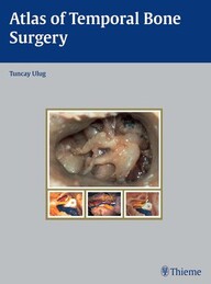 Atlas of Temporal Bone Surgery 1st Edition PDF