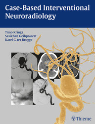 Case-Based Interventional Neuroradiology 1st Edition PDF