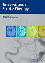Interventional Stroke Therapy 1st Edition PDF