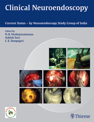 Clinical Neuroendoscopy: Current Status by Neuroendoscopy Study Group of India PDF