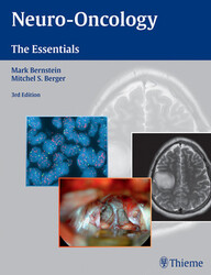 Neuro-Oncology: The Essentials 3rd Edition PDF
