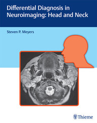 Differential Diagnosis in Neuroimaging: Head and Neck: Head and Neck 1st Edition PDF