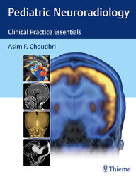 Pediatric Neuroradiology: Clinical Practice Essentials 1st Edition PDF