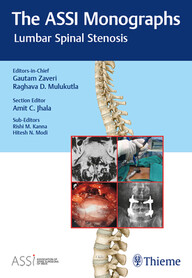 Association of Spine Surgeons of India (ASSI) Monograph Series, Volume 1: Lumbar Spinal Stenosis PDF