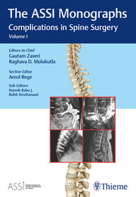 Association of Spine Surgeons of India (ASSI) Monograph Series: Complications in Spine Surgery Volume: 1 PDF