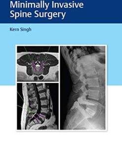 Instrumentation for Minimally Invasive Spine Surgery 1st Edition