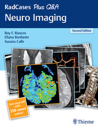 RadCases Plus Q&A Neuro Imaging 2nd Edition PDF