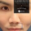 Decision Making in Aesthetic Practice: The Right Procedures for the Right Patients 1st Edition PDF