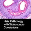 Hair Pathology with Trichoscopic Correlations PDF
