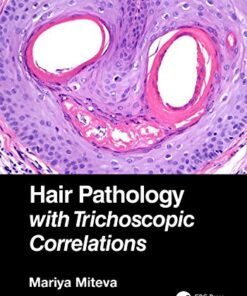 Hair Pathology with Trichoscopic Correlations PDF