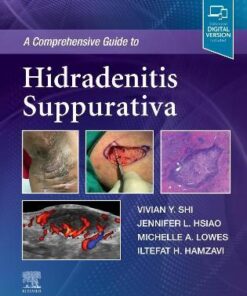 A Comprehensive Guide to Hidradenitis Suppurativa PDF & Video