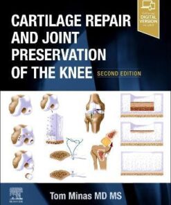 Cartilage Repair and Joint Preservation of the Knee 2nd Edition PDF & Video