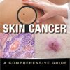 Skin Cancer: A Comprehensive Guide 1st Edition PDF Original