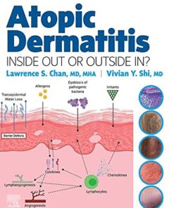 Atopic Dermatitis: Inside Out or Outside In 1st Edition PDF Original