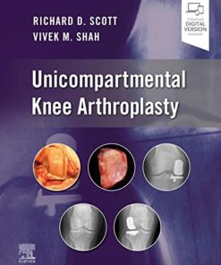 Unicompartmental Knee Arthroplasty 1st Edition PDF Original
