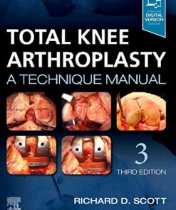 Total Knee Arthroplasty: A Technique Manual 3rd Edition PDF Original
