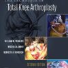 The Technique of Total Knee Arthroplasty 2nd Edition PDF Original