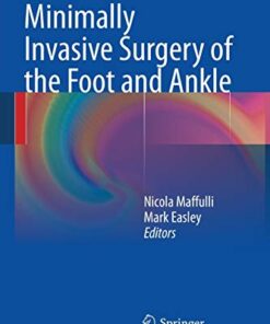 Minimally Invasive Surgery of the Foot and Ankle Softcover reprint of the original 1st ed. 2011 Edition PDF Original