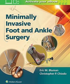 Minimally Invasive Foot & Ankle Surgery (Minimally Invasive Orthopaedic Surgery) First Edition PDF