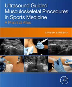 Ultrasound Guided Musculoskeletal Procedures in Sports Medicine: A Practical Atlas 1st Edition PDF Original