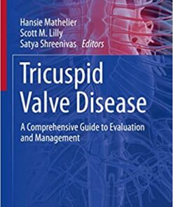 Tricuspid Valve Disease: A Comprehensive Guide to Evaluation and Management (Contemporary Cardiology) (Original PDF from Publisher)