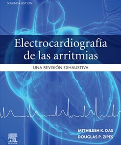 Electrocardiografía de las arritmias: Una revisión exhaustiva, 2nd edition (Original PDF from Publisher)