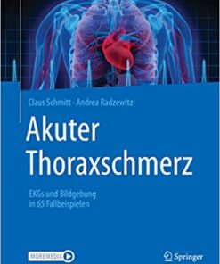 Akuter Thoraxschmerz: EKGs und Bildgebung in 65 Fallbeispielen (German Edition) (Original PDF from Publisher)