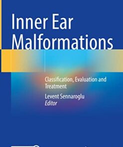 Inner Ear Malformations: Classification, Evaluation and Treatment 1st ed. 2022 Edition PDF Original