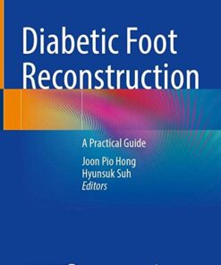 Diabetic Foot Reconstruction: A Practical Guide 1st ed. 2022 Edition PDF Original