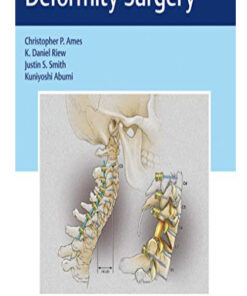 Cervical Spine Deformity Surgery (Original PDF from Publisher)