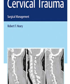 Cervical Trauma: Surgical Management (Original PDF from Publisher)