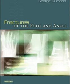 Fractures of the Foot and Ankle (Original PDF From Publisher)