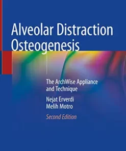 Alveolar Distraction Osteogenesis: The ArchWise Appliance and Technique, 2nd Edition (Original PDF from Publisher)