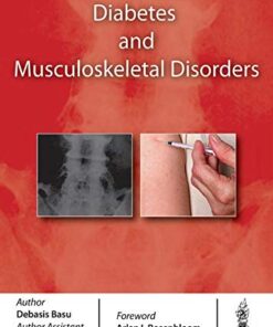 Diabetes and Musculoskeletal Disorders (Original PDF from Publisher)