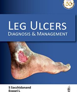 Leg Ulcers: Diagnosis and Management (Original PDF from Publisher)