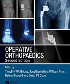 Operative Orthopaedics, 2ed (Original PDF from Publisher)