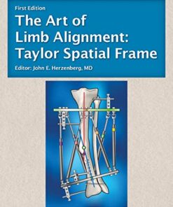 The Art of Limb Alignment: Taylor Spatial Frame (Original PDF from Publisher)