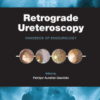 Retrograde Ureteroscopy Handbook of Endourology