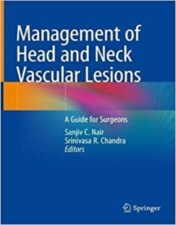 Management of Head and Neck Vascular Lesions A Guide for Surgeons 2022 Original pdf