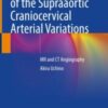 Atlas of the Supraaortic Craniocervical Arterial Variations MR and CT Angiography Original pdf