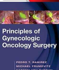 Principles of Gynecologic Oncology Surgery 1st Edition