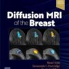 Diffusion weighted imaging (DWI) is a key emerging imaging modality for the management of patients with possible breast lesions, and Diffusion MRI of the Breast is the first book to focus on all aspects of DWI in today’s practice.