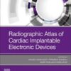 radiographic-atlas-of-cardiac-implantable-electronic-devices