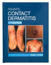 Fisher’s Contact Dermatitis, 7th Edition