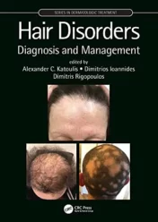 Hair Disorders: Diagnosis and Management (Series in Dermatological Treatment) 1st Ed
